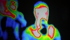 Thermal Imaging