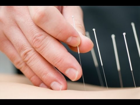Chinese Medicine