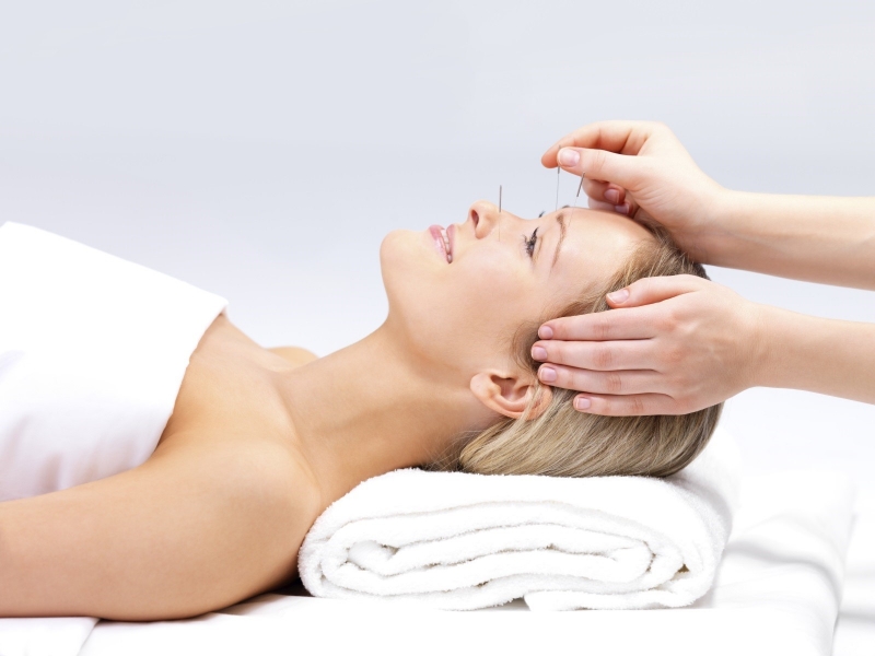 Acupuncture